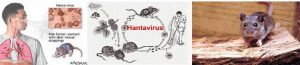 হ্যান্টাভাইরাস পালমোনারি সিনড্রোম (Hantavirus pulmonary syndrome - HPS)